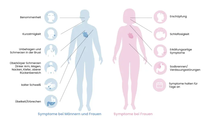 Langfristige vorzeichen herzinfarkt: Benommenheit, Kurzatmigkeit, Brustschmerz, Oberkörperschmerz, kalter Schweiß, Übelkeit. Bei Frauen auch Erschöpfung, Schlaflosigkeit, Erkältungssymptome, Sodbrennen.