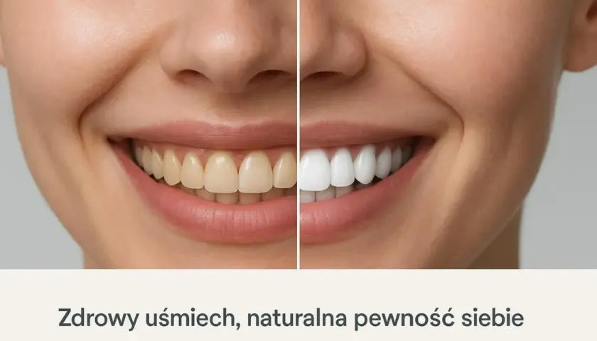 Porównanie uśmiechu: zęby żółte po lewej, białe po prawej. Czy cytryna wybiela zęby? Zdrowy uśmiech, naturalna pewność siebie.