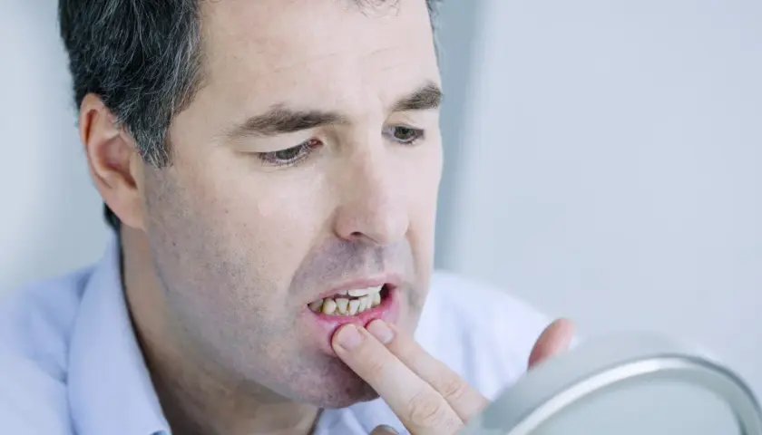 Ból dziąseł: Przyczyny, domowe sposoby i kiedy iść do dentysty