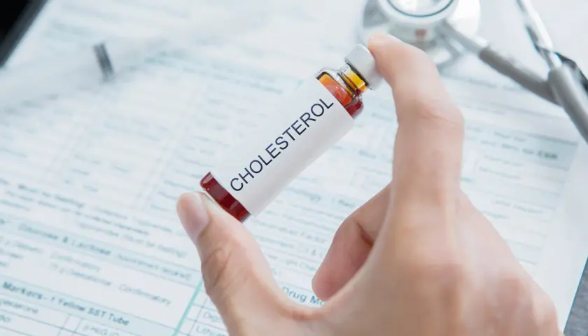 Dłoń trzyma fiolkę z napisem "CHOLESTEROL" na tle dokumentacji medycznej i stetoskopu. Czy tabletki na cholesterol trzeba brać do końca życia?