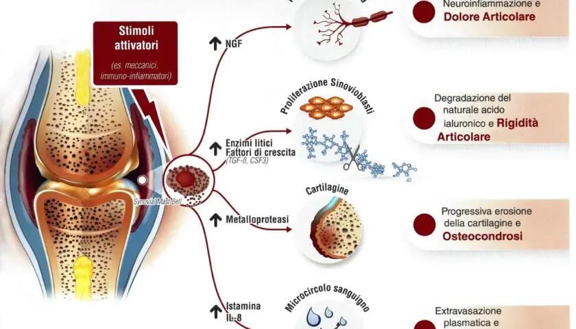 Il mastocita sinoviale, stimolato, rilascia mediatori che causano neuroinfiammazione, degradazione cartilaginea e dolore articolare. L'effetto del pea è da valutare in base alla patologia.