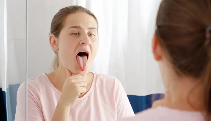 Mujer se mira en el espejo, mostrando su lengua blanca, preocupada por un posible dolor de garganta.