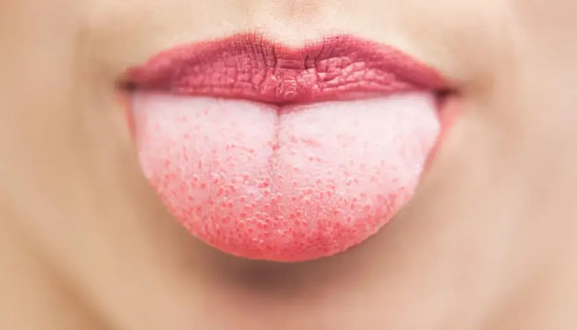 Lingua gonfia, segno di stress. La bocca è aperta, le labbra rosse e la lingua rosa sporge, mostrando la sua superficie ruvida.