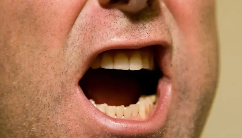 Primo piano di una bocca aperta, con denti visibili. La sensazione di bocca secca ansia è palpabile.