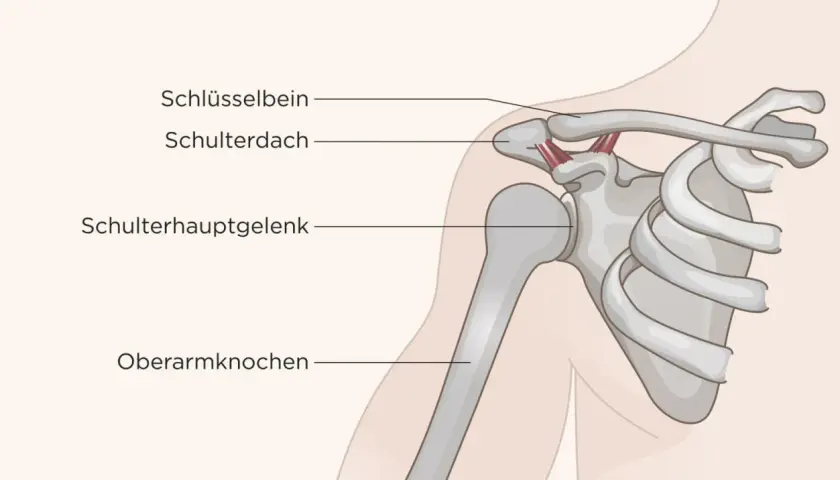 Anatomie der Schulter mit Schlüsselbein, Schulterdach und Oberarmknochen. Mögliche Ursache für Schulterschmerzen beim Arm heben.