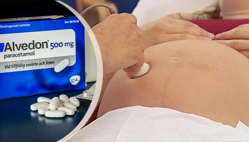 Alvedon paracetamol för gravid. En gravid mage undersöks med ultraljud.
