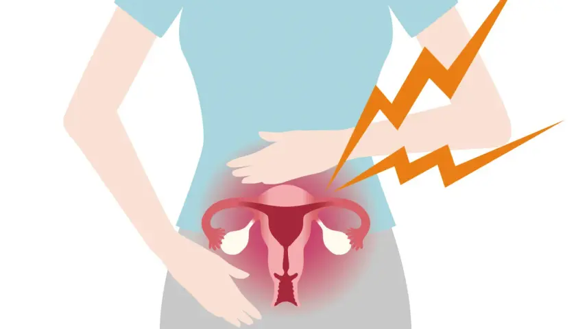 Illustration av en gravid kvinna som håller sig om magen. Hon upplever ont i underlivet, symboliserat av blixtar.