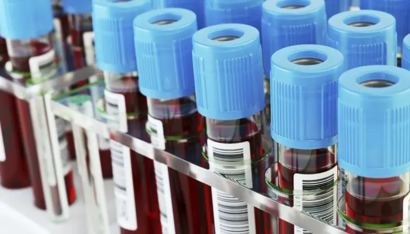 Rząd probówek z krwią, każda z niebieską zakrętką. W tle widać więcej probówek, tworząc laboratoryjny prf.