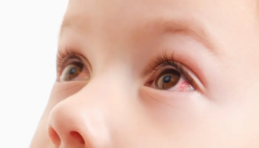 Occhio di neonato con una piccola macchia rossa, forse un segno di stanchezza o irritazione.