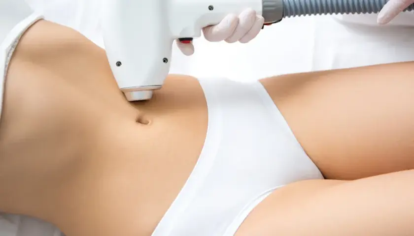 Depilacja laserowa bikini: harmonogram i sekrety trwałej gładkości