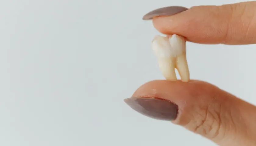 Co dentysta robi z wyrwanym zębem? Oto co musisz wiedzieć