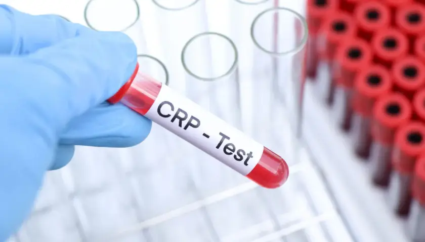 Ręka w niebieskiej rękawiczce trzyma probówkę z krwią oznaczoną "CRP - Test". W tle widać stojak z innymi probówkami.