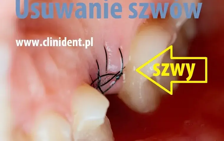 Ile kosztuje zdjęcie szwów u dentysty? Ceny, które zaskoczą!