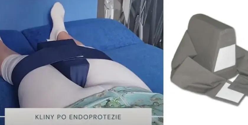 Czy po endoprotezie biodra przysługuje renta? Sprawdź warunki i pomoc