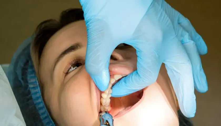 Un dentista usa guantes azules para extraer dientes. Se ven los puntos reabsorbibles en la boca de la paciente.