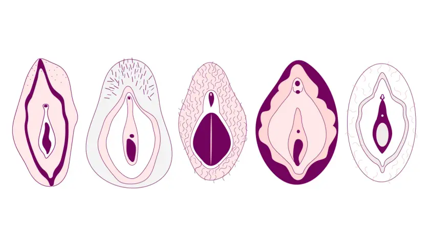 Fem olika vulvor, vissa med hår på snippan, visar variationen i anatomin.