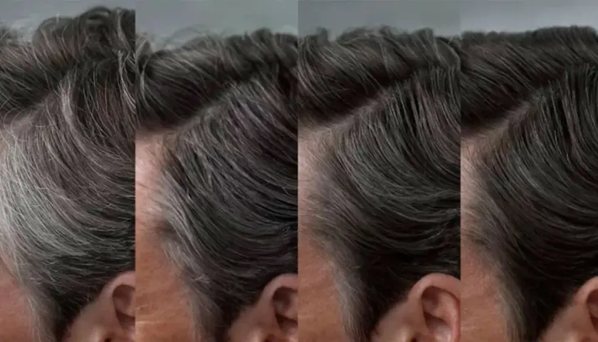 El pelo blanco de un hombre se transforma en oscuro.
