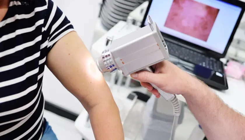 Dermatoskopia co to? Lekarz bada znamiona na ramieniu pacjentki za pomocą dermatoskopu, obraz widoczny na ekranie laptopa.