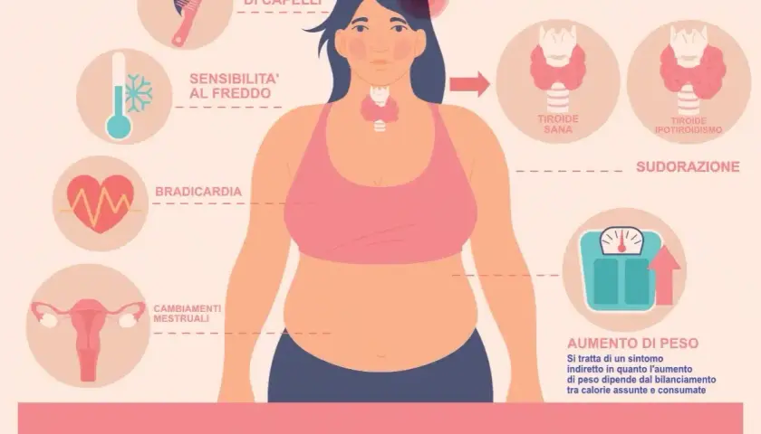 Ipotiridismo: sintomi come perdita capelli, stanchezza, aumento peso e ansia. La tiroide ipotiroidea causa questi disturbi.