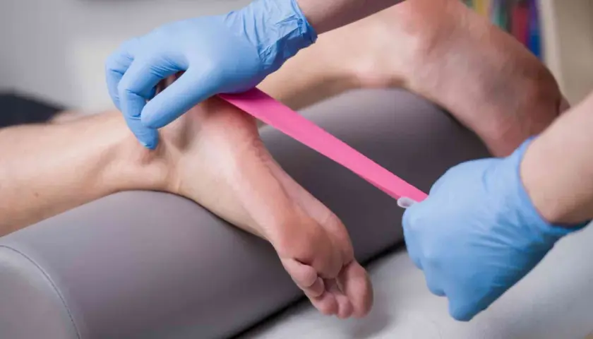 Fizjoterapeuta zakłada taśmę kinezjotaping na stopę, wspierając ćwiczenia na ostrogę piętową.