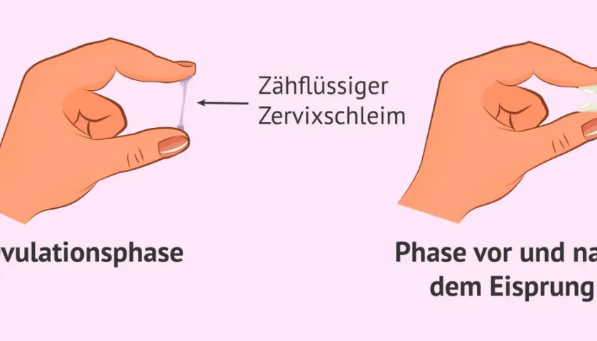 Hände zeigen Zervixschleim: zähflüssig in der Ovulationsphase, klumpig vor und nach dem Eisprung. Ein wichtiges Zeichen für Eisprung Symptome.