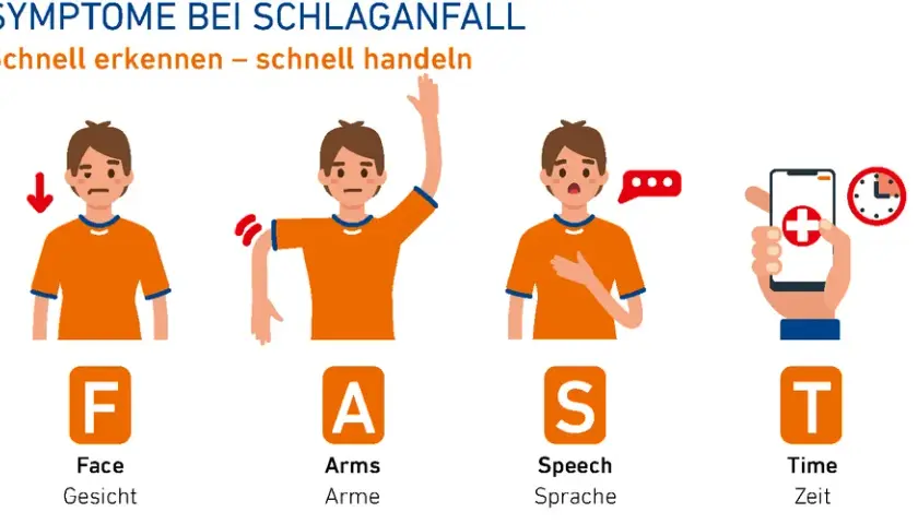 Apoplexie Symptome: Erkennen Sie die alarmierenden Anzeichen sofort