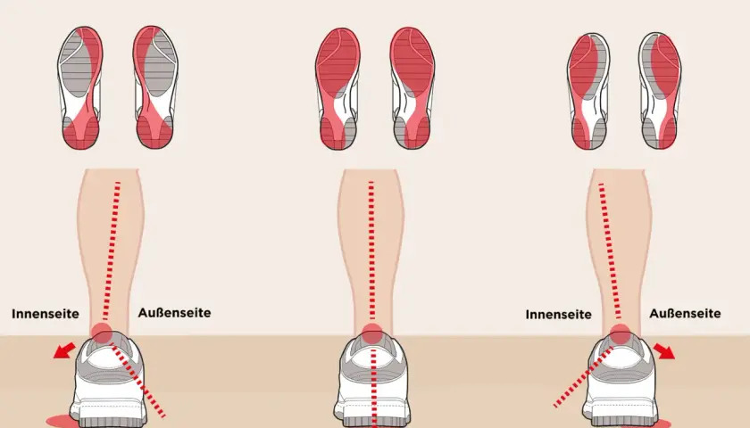 Illustration zeigt drei Laufstile: Pronation, Neutral und Supination. Bei Pronation knickt der Fuß nach innen ab.