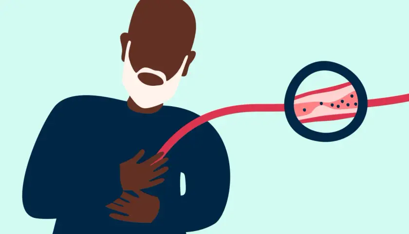 Homme ressentant un pincement poitrine gauche. Une artère montre des dépôts, suggérant un problème circulatoire.