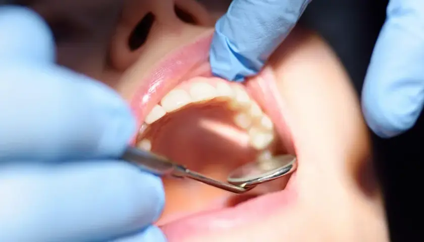 Dentysta bada zęby, szukając oznak próchnicy wtórnej.