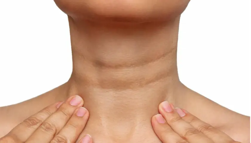 Cuello con acantosis nigricans, mostrando la hiperpigmentación y textura irregular. Se exploran opciones de tratamiento.