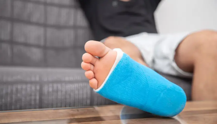 Niebieski gips na nodze, która odczuwa ból kostki po wewnętrznej stronie.