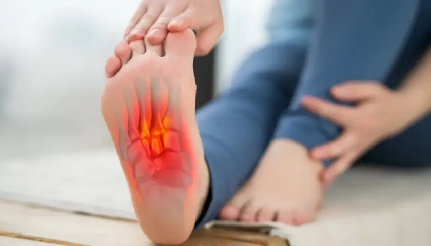 Pie con dolor e inflamación en la planta, indicando fascitis plantar.