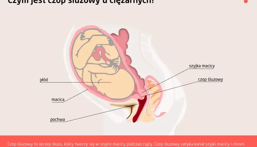 Ilustracja anatomiczna przedstawiająca płód w macicy, szyjkę macicy i czop śluzowy.