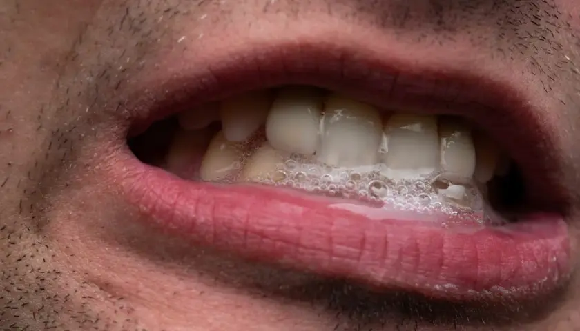 Bocca con schiuma e denti visibili. La salivazione eccessiva può essere un sintomo di ansia.