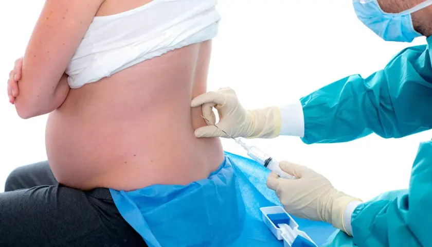 Läkare ger en epidural till en gravid kvinna. Detta kan vara ett alternativ för smärtlindring vid förlossning, inte relaterat till slempropp gravid.
