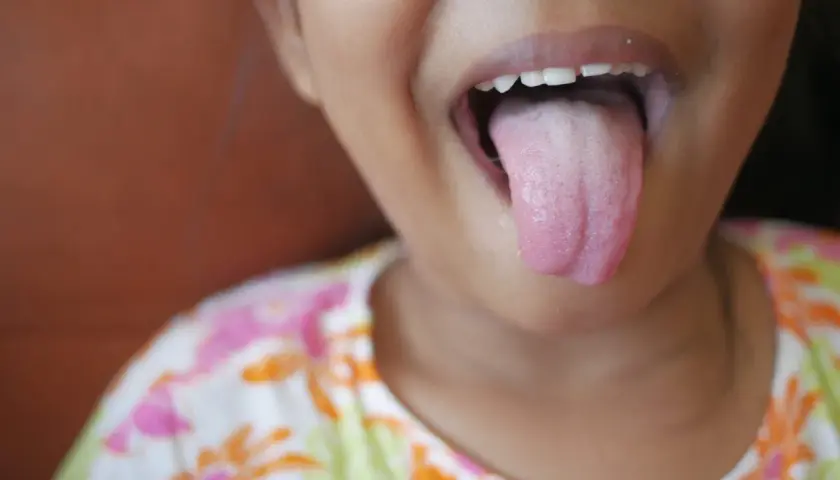Niña saca la lengua, mostrando una capa blanca. Podría necesitar remedios caseros para la lengua blanca.