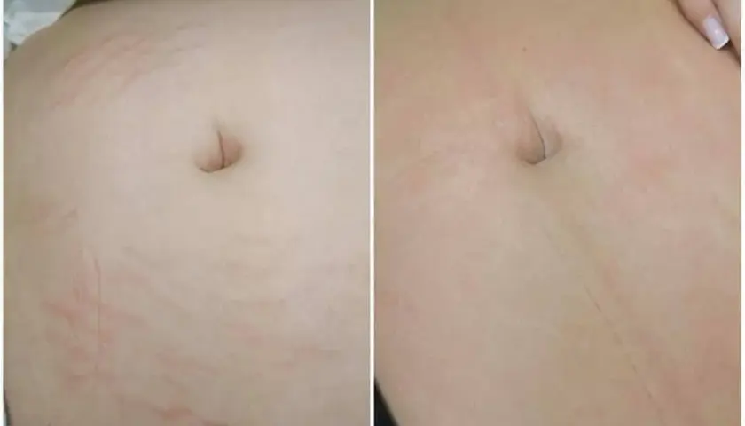 Gdzie kupić deep phyto peeling i uniknąć nieefektywnych produktów