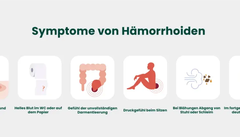 Hämorrhoiden Symptome: Erkennen Sie die Anzeichen und vermeiden Sie Schmerzen
