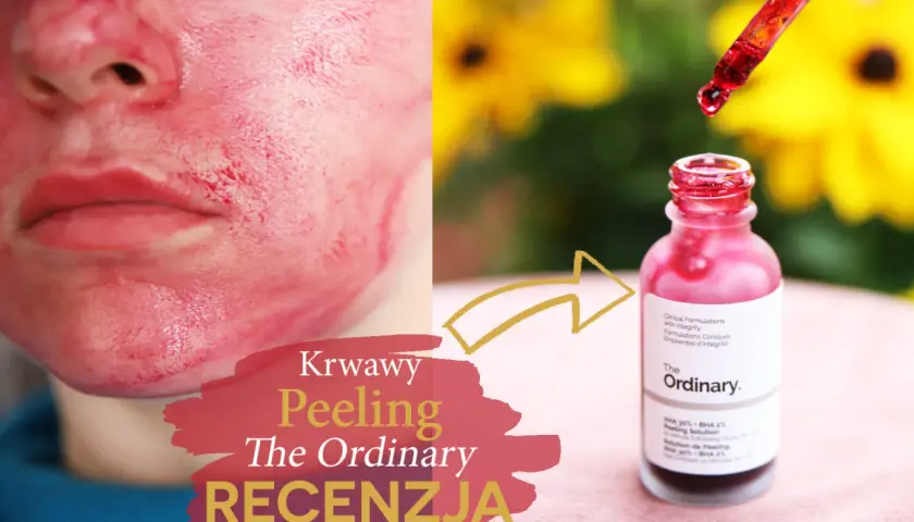 Krwawy peeling The Ordinary na twarzy i buteleczka z pipetką. Recenzja produktu.