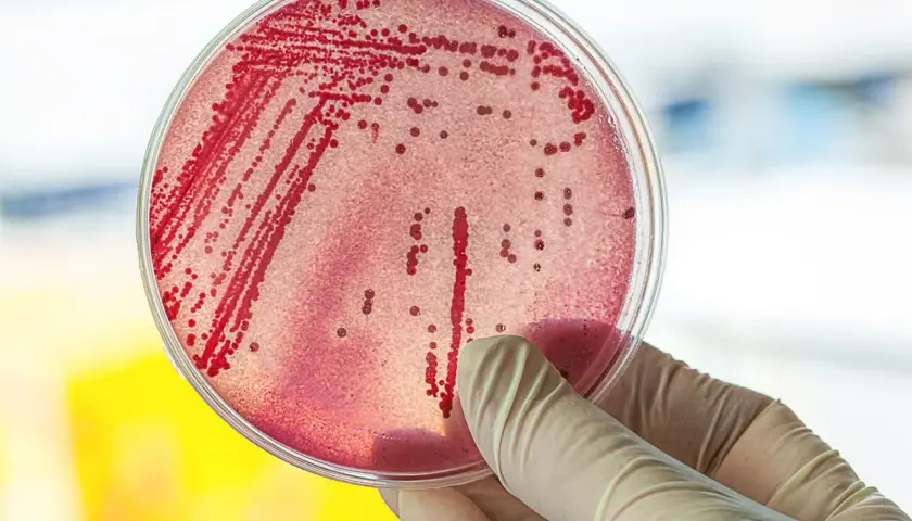 Symptome E. coli: Erkennen Sie die gefährlichen Anzeichen einer Infektion