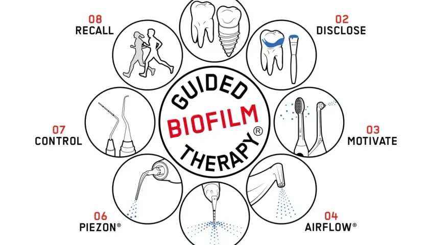 Schema della Guided Biofilm Therapy: diagnosi, rivelazione del biofilm batterico denti, motivazione, Airflow, Perioflow, Piezon, controllo e richiamo.