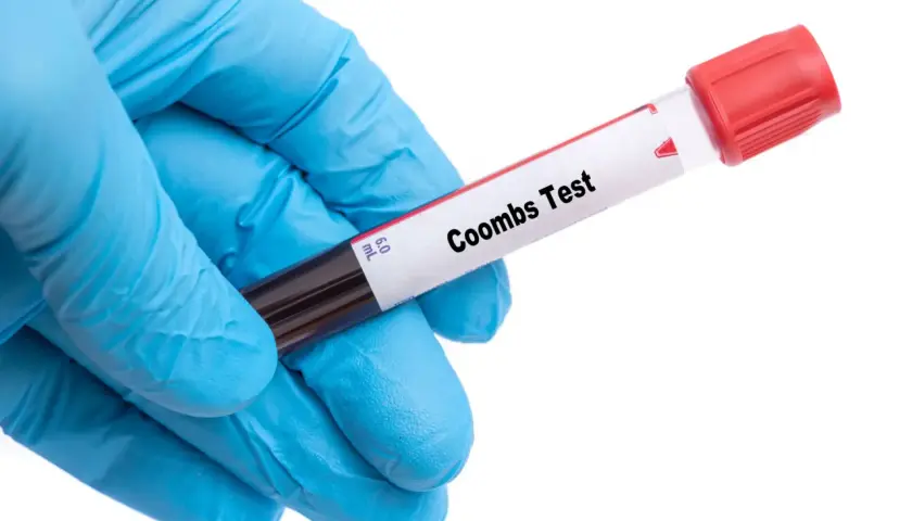 Rękawiczka w kolorze niebieskim trzyma probówkę z krwią do badania. Na probówce widnieje napis "Coombs Test".