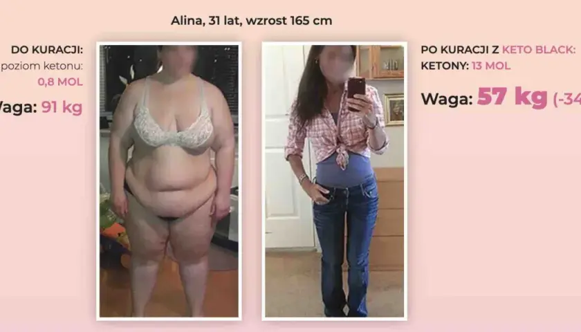 Przed i po kuracji Keto Black. Alina schudła 34 kg, co pokazuje, na czym polega dieta keto.