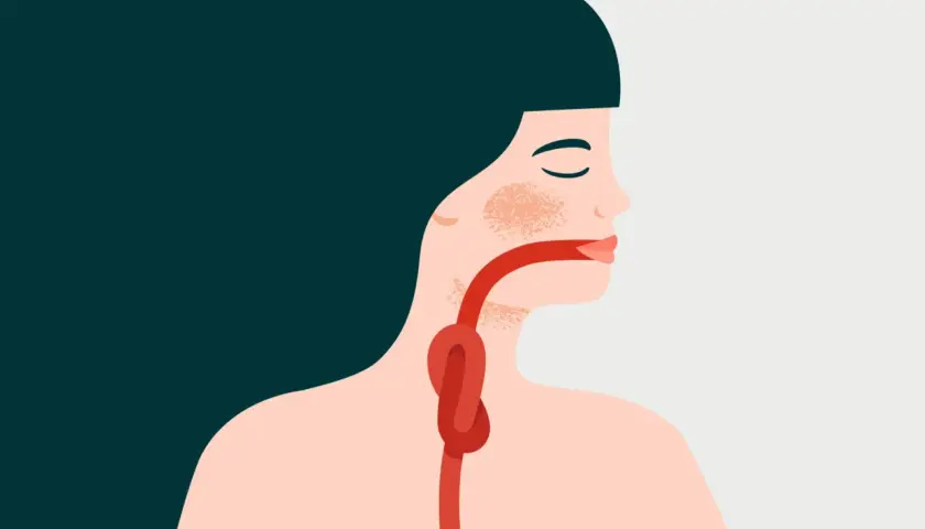 Illustration d'une personne avec un nœud dans la gorge, symbolisant la difficulté à avaler sa salive.