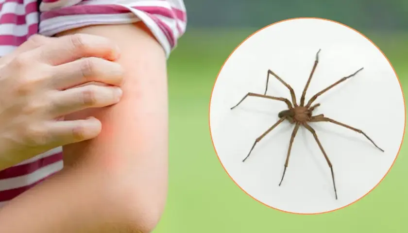 Brazo con erupción roja y picazón, junto a una araña marrón. Aprende cómo curar picadura de araña.