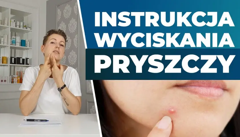 Pryszcze: Wyciskać czy nie? Poradnik eksperta i "trójkąt śmierci"
