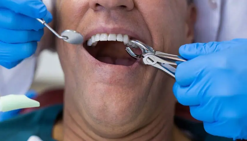 Dentista realiza extracción de muela infectada a paciente.