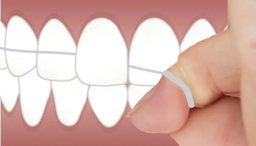 Dente pulito grazie al filo interdentale. Impara come usare il filo interdentale per una perfetta igiene orale.