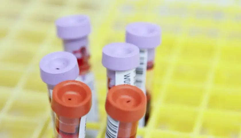 Krebsvorsorge Blutuntersuchung: Wie der PanTum Detect Test Leben retten kann