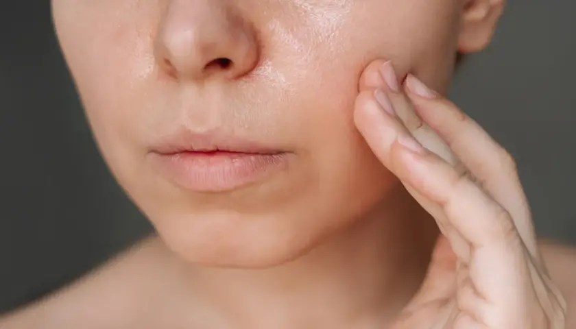 Primer plano de una cara con piel grasa, mostrando la textura brillante y la mano tocando suavemente la mejilla.